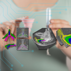 Fotomontaje con imágenes de la reconstrucción tridimensional de la red nerviosa del clítoris.