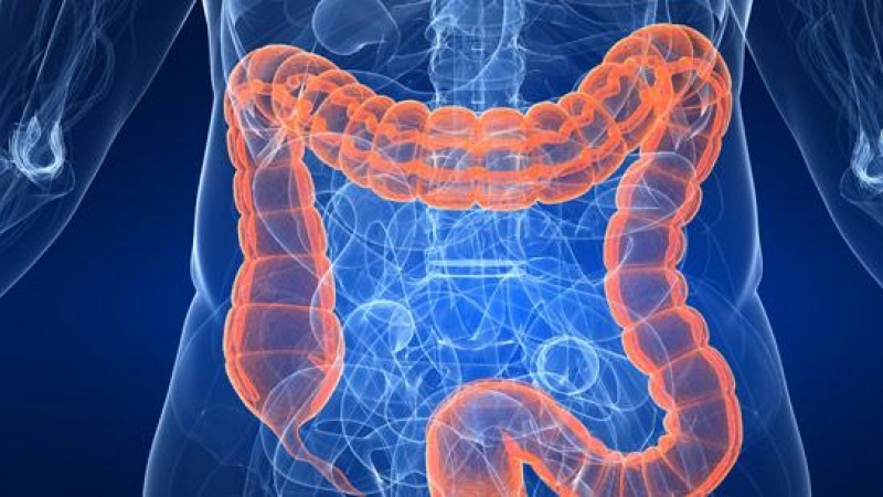 El cáncer de colon es de los más comunes en España, con 41.000 nuevos casos anuales