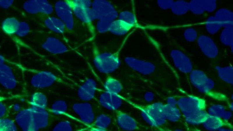 Neuronas normales tintadas para distinguir su cuerpo (en azul) de los axones (en verde)./SALK INSTITUTE