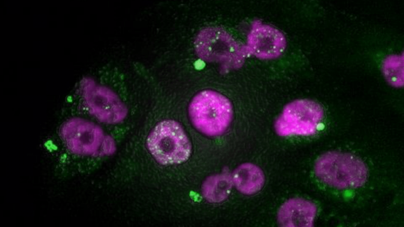 Células tumorales de adenocarcinoma de páncreas que muestran signos de daño en el ADN del núcleo (puntos blancos) y de micronúcleos (en verde), después de un tratamiento con taxol seguido de inhibidores de CDK4/6. /CNIO