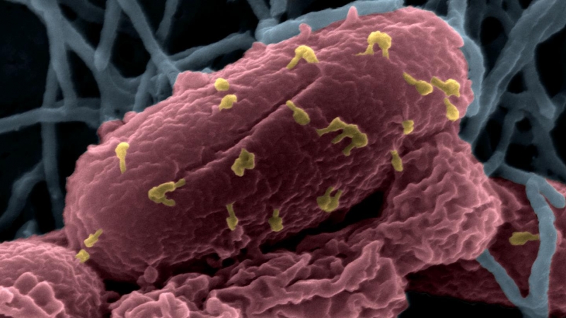 Bacterias E. coli atacadas por bacteriófagos (en amarillo), al microscopio./ INSTITUT PASTEUR