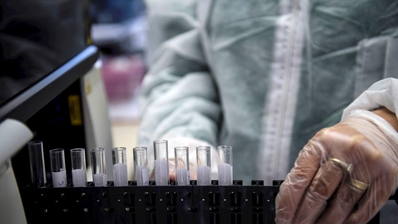 Un médico manipula unas muestras en un laboratorio, en una imagen de archivo. EFE/EPA/Julien de Rosa