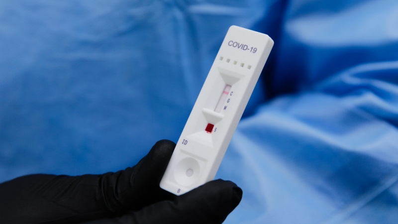 Un test positivo de coronavirus / Efe