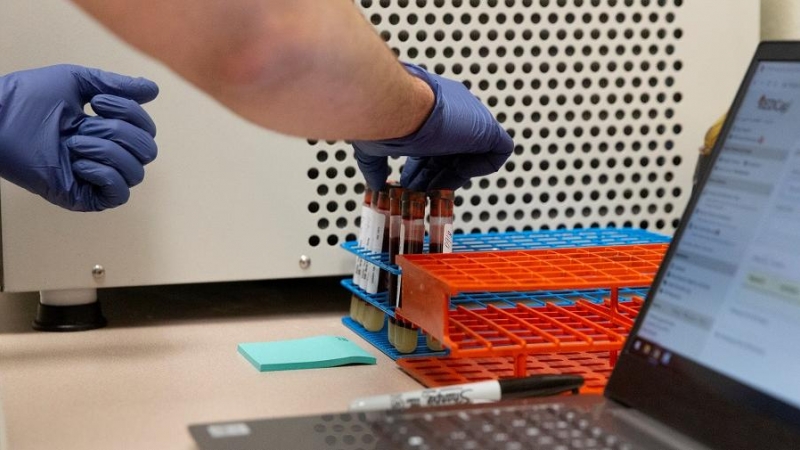 Francisco Soto, asistente de investigación en la Universidad de Arizona, prepara muestras de sangre para la prueba de anticuerpos para la enfermedad por coronavirus (COVID-19) en Tucson, Arizona, EE. UU., 10 de julio de 2020. REUTERS / Cheney Orr