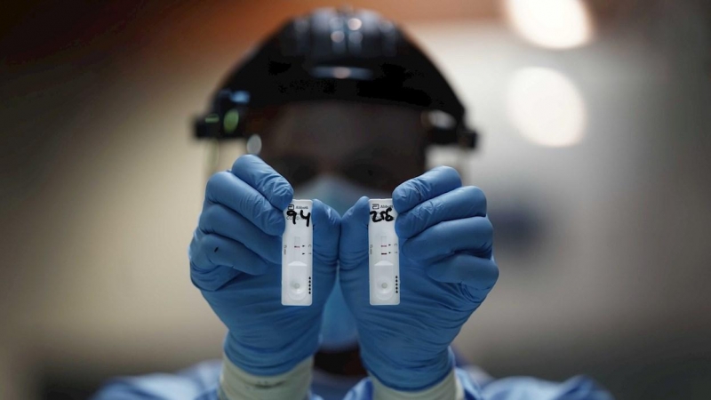 01/10/2020.- Un sanitario sostiene dos pruebas de test rápido de antígenos en la mano para la detección de la covid-19 en Córdoba. / EFE - Rafa Alcaide