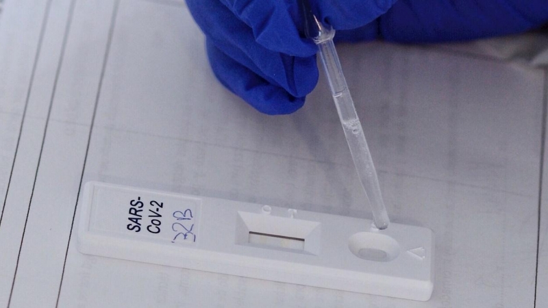 Realización de test rápido de PCR