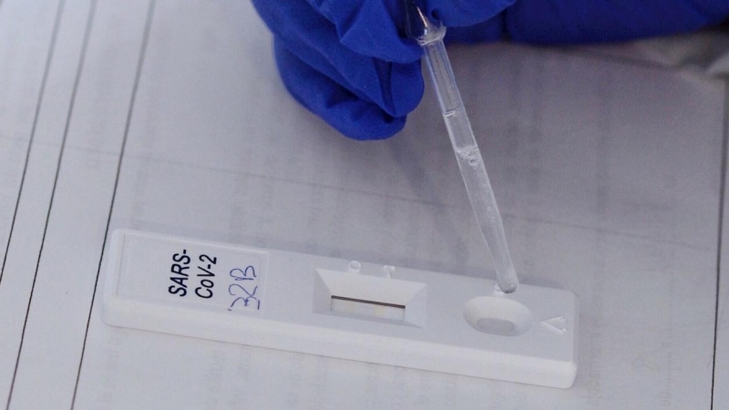 Realización de test rápido de PCR