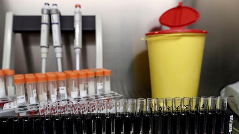La segunda vacuna rusa contra la covid tendrá una inmunidad de al menos 6 mese, según el Gobierno de Rusia.