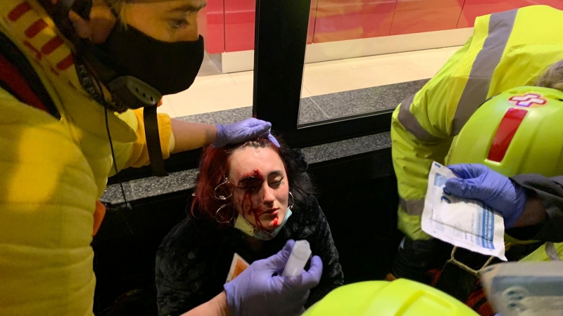La noia ferida per una bala de foam durant la manifestació en suport a Pablo Hasél.