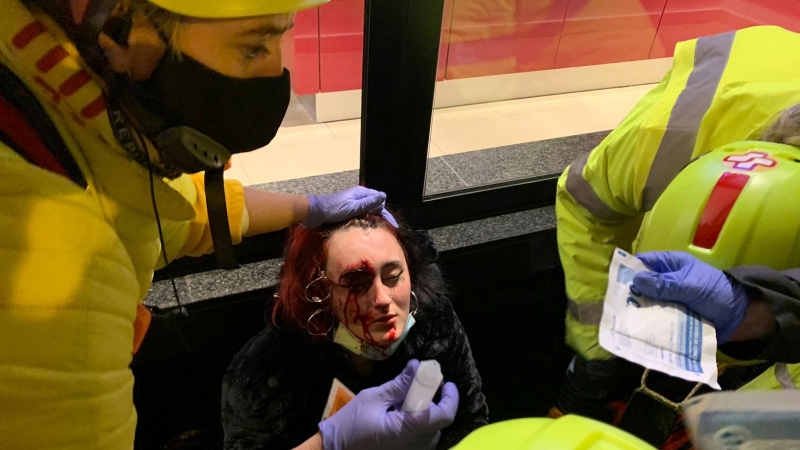 Foto de la mujer herida por una bala foam en la protesta por la encarcelación de Pablo Hasél.