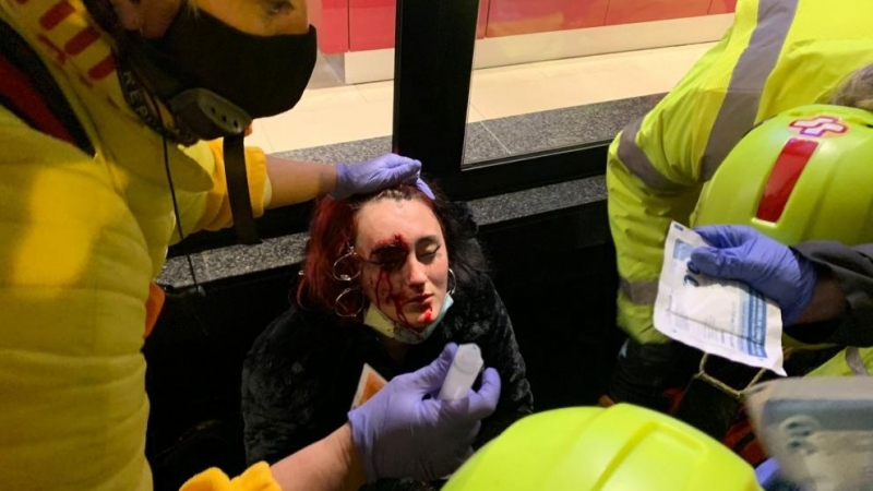 Foto de la mujer herida por una bala foam en la protesta por la encarcelación de Pablo Hasél.