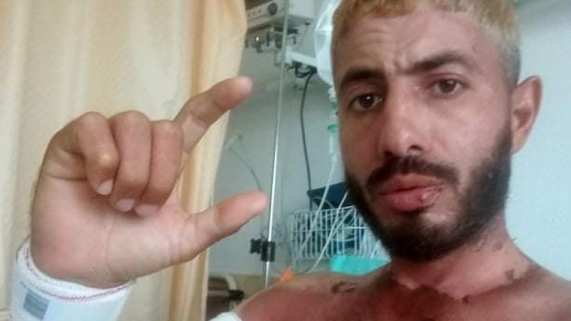 Khaled, en el hospital el día del alta, con un brazo maltrecho arriba y la parte del cuerpo no sumergida quemada por el sol.