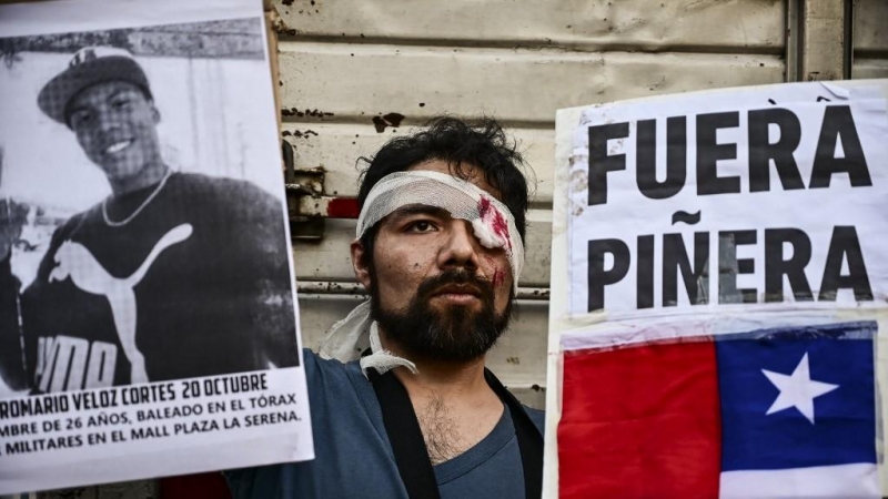 Un manifestante con un ojo vendado sostiene un cartel que dice 'Piñera fuera' durante una manifestación contra el presidente chileno Sebastián Piñera en Buenos Aires, el 5 de noviembre de 2019, mientras Chile sufre el peor brote de malestar social en déca