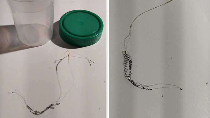 Imágenes en detalle de un dispositivo anticonceptivo Essure