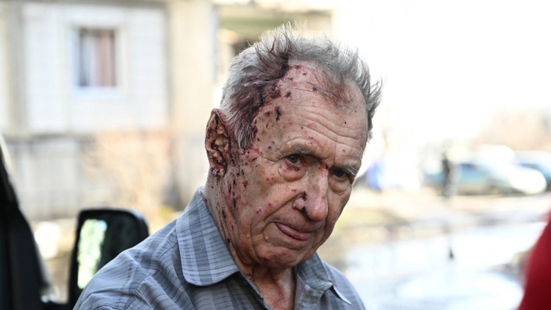 Un hombre herido junto a un vehículo de una unidad de emergencia para recibir asistencia médica después de los bombardeos en la ciudad de Chuguiv, en el este de Ucrania, este 24 de febrero.