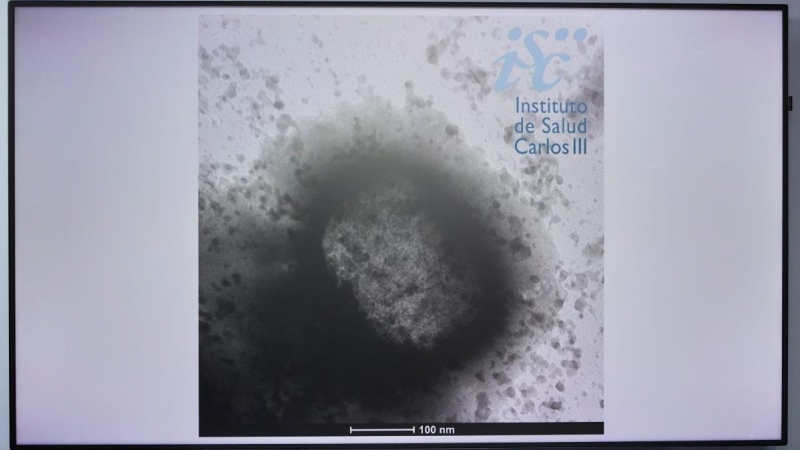 Una molécula de la viruela del mono como resultado de un estudio de la universidad Carlos III, a 25 de mayo de 2022, en Madrid.