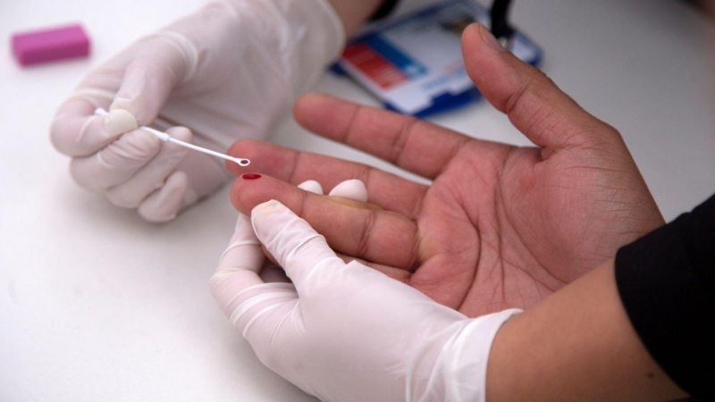 Imagen de archivo de un hombre realizándose una prueba rápida de VIH en Santiago de Chile el 23 de junio de 2018.