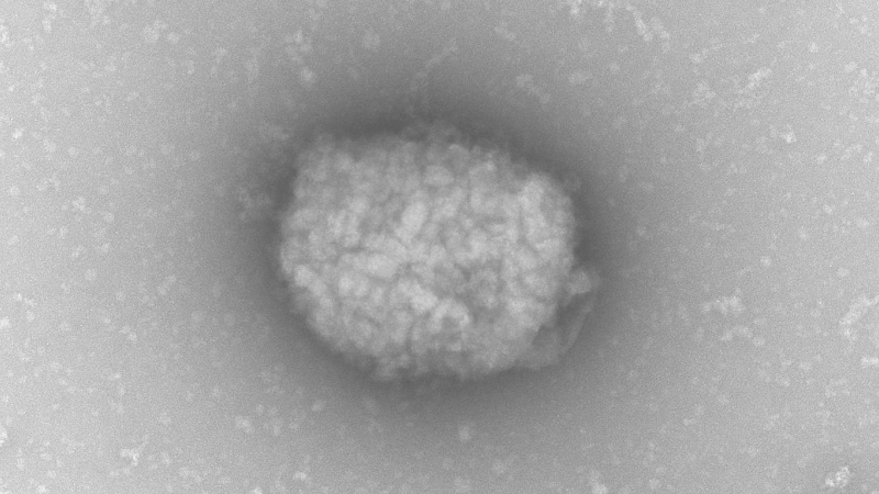 06/06/2022-Partículas virales del virus del mono observadas por microscopia electrónica de transmisión directamente del líquido obtenido de pústulas de pacientes infectados.