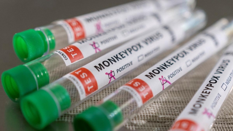 Tubos utilizados en los laboratorios etiquetados como 'positivo en virus del mono'