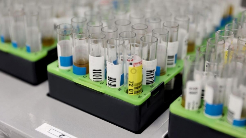 Probetas de pruebas PCR en el Laboratorio de Microbiología del Hospital público Gregorio Marañón, a 31 de mayo de 2022, en Madrid.