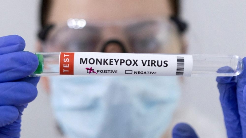 Una sanitaria sostiene un vial de una prueba de detección de la viruela del mono.