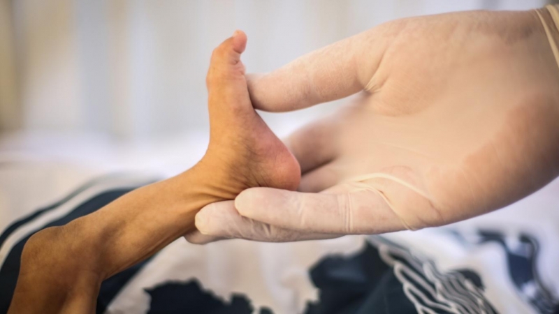 13/6/21 Una enfermera sujeta la pierna de un niño que sufre desnutrición aguda en un hospital de Idlib (Siria), a 13 de junio de 2021.