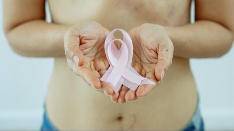 Una mujer sostiene el lazo rosa, símbolo de la lucha contra el cáncer de mama.