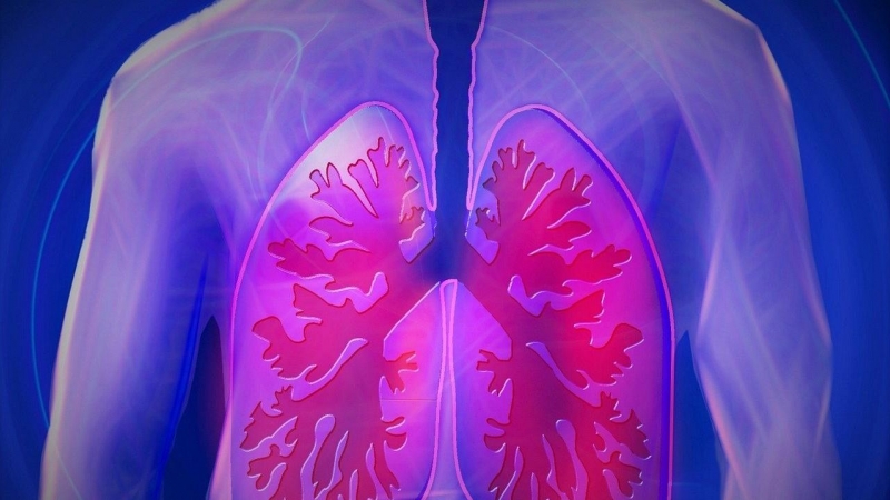 Cancer de pulmón