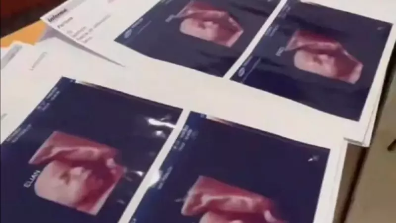 Las imágenes de las ecografías 5D que la clínica de Formosa, Argentina, que entregaban a las mujeres