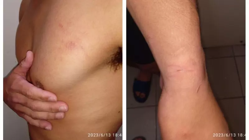 Imágenes de las marcas de la presunta agresión policial denunciada por Remigio tras su primer intento de expulsión.