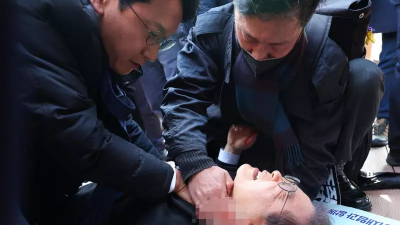 El líder de la oposición surcoreana Lee Jae-myung tras el ataque en Busan, a 2 de enero de 2024.