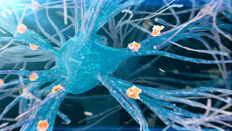 Ilustración que muestra placas amiloides (naranja) formándose alrededor de las neuronas (azul). Las placas amiloides son agregados de proteínas mal plegadas que se cree que desempeñan un papel crucial en la enfermedad de Alzheimer.