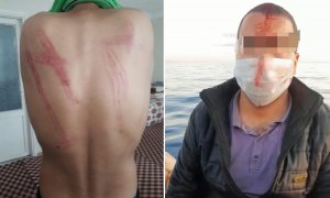 Izquierda: hematomas tras haber sido golpeado por las autoridades griegas durante la expulsión desde el campo de Diavata el 15-16 de abril.-BORDER VIOLENCE MONITORING NETWORK Derecha: hombre herido en la operación del 29 de mayo cerca de la isla de Lesbos