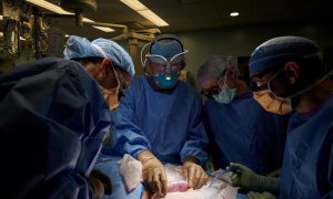 Fotografía de los investigadores estudiando el riñón de cerdo en la operación.