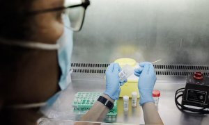 30/05/2022-vUna técnico de laboratorio sostiene una de las pruebas de análisis para la viruela del mono, en el Hospital Ramón y Cajal, a 30 de mayo de 2022, en Madrid