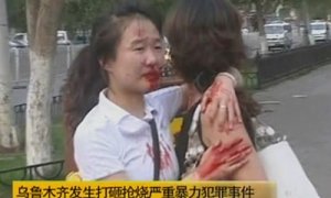 Una herida en los disturbios, en la TV china. - REUTERS
