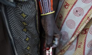 Imagen de una cuchilla con la que se realiza la ablación genital femenina.- REUTERS