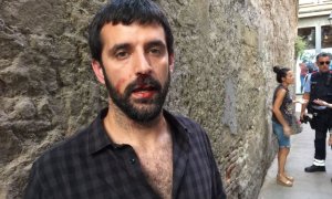 Jordi Borràs, después de la agresión. Imagen cedida por 'El Món'/QS