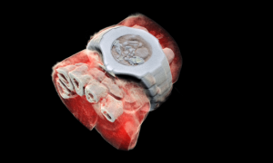 Muñeca humana con reloj de pulsera escaneada con rayos X en color y tres dimensiones./ MARS