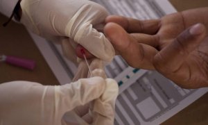 Detalle de la mano de hombre que se realiza la prueba del VIH | EFE/Archivo