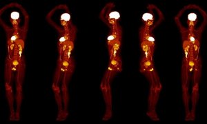 : Varias imágenes de un cuerpo humano completo obtenidas por el nuevo escáner Explorer./UCDAVIS/UNITED IMAGING
