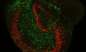 Imagen de fluorescencia de una rodaja cultivada de hipocampo de rata donde se muestran los somas de las neuronas (en rojo) y de los astrocitos (en verde). / CSIC