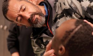 El cirujano Cavadas extirpa a un niño un tumor más grande que su cabeza