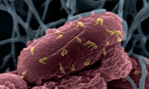 Bacterias E. coli atacadas por bacteriófagos (en amarillo), al microscopio./ INSTITUT PASTEUR