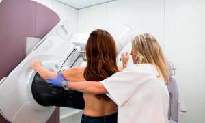 Una mujer se somete a una mamografía. Europa Press / Archivo