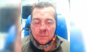 Brutal paliza a un hombre trans en Toledo al grito de "a ver si pegas como un chico o como lo que eres, una tía"