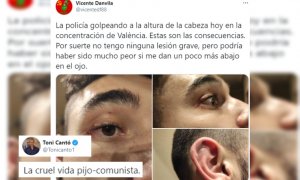 Toni Cantó se ríe de un manifestante que denuncia una agresión policial en una manifestación en apoyo a Pablo Hasél
