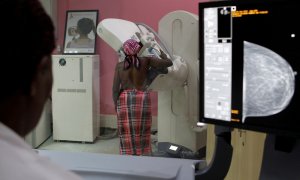 Una mujer haciéndose una mamografía preventiva en un Hospital en Nairobi.