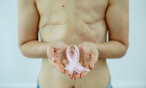 Imagen de archivo. Una mujer sostiene el lazo rosa, símbolo de la lucha contra el cáncer de mama.