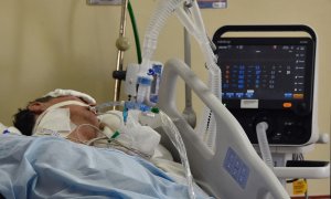 23/3/22-Paciente en un hospital de Quito (Ecuador), a 19 de enero del 2022.